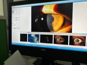 Diopta Eye Care Center - photo 9
